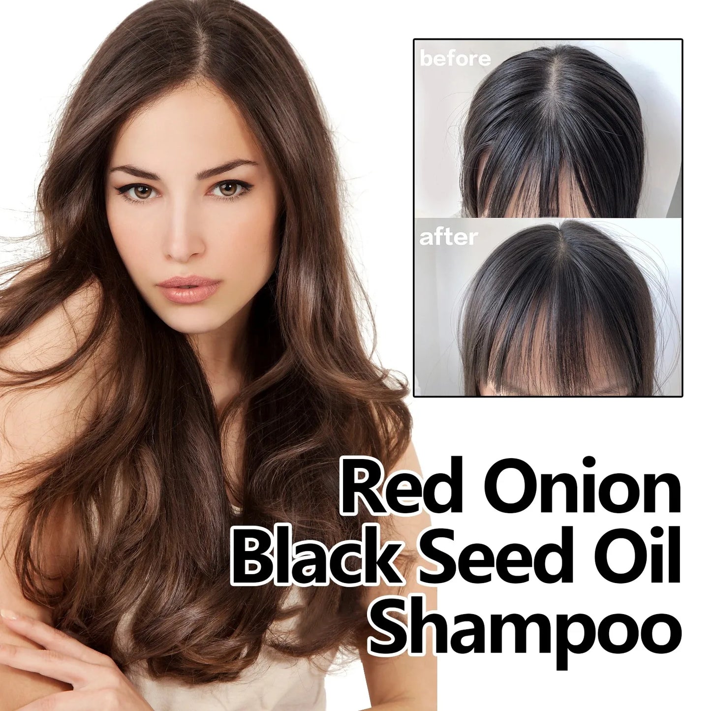 Eelhoe Red Onion Shampoo Black Seed Oil Hair Care Shampoo Hair Care Cleansing Scalp Refreshing Shampoo Hair Care Oil